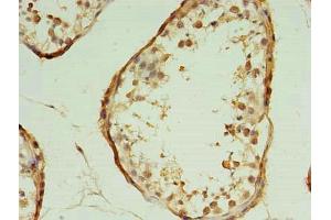 Immunohistochemistry of paraffin-embedded human testis tissue using ABIN7172357 at dilution of 1:100 (TRAPPC2L antibody  (AA 1-139))