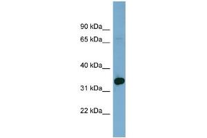 WB Suggested Anti-HOXD12 Antibody Titration: 0. (HOXD12 antibody  (Middle Region))