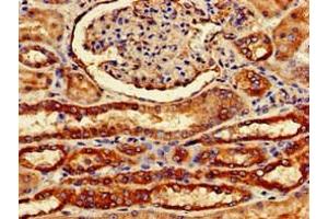 Immunohistochemistry of paraffin-embedded human kidney tissue using ABIN7153175 at dilution of 1:100 (FZD1 antibody  (AA 73-322))