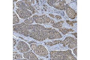 IHC analysis of TRMT6 using anti-TRMT6 antibody (ABIN7602138).