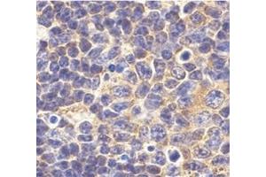 Immunohistochemistry of TLR1 in mouse spleen tissue with this product at 10 μg/ml. (TLR1 antibody  (N-Term))