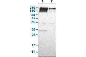 Western Blot analysis with PARP4 polyclonal antibody . (PARP4 antibody  (AA 247-392))