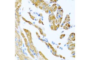 Immunohistochemistry of paraffin-embedded mouse heart using COL9A3 antibody. (COL9A3 antibody)