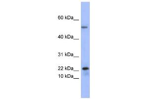 WB Suggested Anti-PLA2G5 Antibody Titration:  0. (PLA2G5 antibody  (Middle Region))