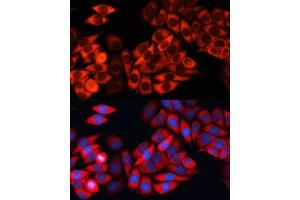 Immunofluorescence analysis of HeLa cells using eIF3B Polyclonal Antibody (ABIN6130364, ABIN6140053, ABIN6140054 and ABIN6214441) at dilution of 1:100 (40x lens).