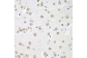 Immunohistochemistry of paraffin-embedded rat brain using PRMT5 antibody at dilution of 1:100 (x40 lens). (PRMT5 antibody)