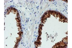 Image no. 2 for anti-Phosphoglucomutase 3 (PGM3) antibody (ABIN1500178) (Phosphoglucomutase 3 antibody)
