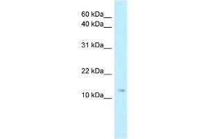 WB Suggested Anti-Stmn1 Antibody Titration: 1.