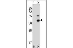 Western blot analysis of Cdk3 (arrow) using rabbit polyclonal Mouse Cdk3 Antibody (C-term) (ABIN657724 and ABIN2846710).