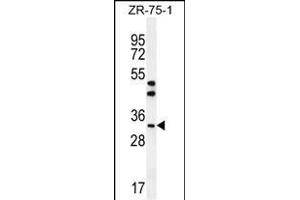 AREG Antibody (C-term) (ABIN392202 and ABIN2841903) western blot analysis in ZR-75-1 cell line lysates (35 μg/lane). (Amphiregulin antibody  (C-Term))