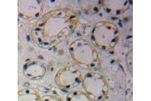 #VALUE! (GLUT1 antibody  (AA 251-329))