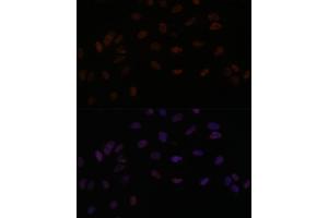 Immunofluorescence analysis of U-2 OS cells using PPP4R3B antibody (ABIN7270374) at dilution of 1:100. (SMEK2 antibody  (AA 628-817))