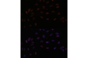 Immunofluorescence (IF) image for anti-SMEK Homolog 2, Suppressor of Mek1 (Dictyostelium) (SMEK2) (AA 628-817) antibody (ABIN7270374)