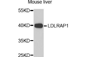 Western blot analysis of extracts of mouse liver, using LDLRAP1 antibody (ABIN5974266) at 1/1000 dilution. (LDLRAP1 antibody)