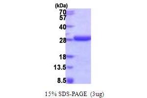 HD Domain Containing 2 (HDDC2) (AA 1-204) protein (His tag)