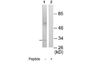 Image no. 1 for anti-MAX-Like Protein X (MLX) antibody (ABIN272258) (MLX antibody)