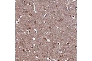 Immunohistochemical staining of human cerebral cortex with KCNG1 polyclonal antibody  shows moderate cytoplasmic positivity in neuronal cells at 1:200-1:500 dilution. (KCNG1 antibody)