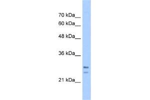 WB Suggested Anti-SRPRB Antibody Titration:  5. (SRPRB antibody  (C-Term))