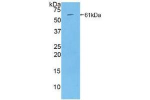Western blot analysis of recombinant Rat THBS4. (THBS4 antibody  (AA 708-963))