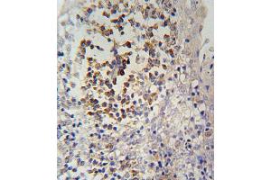 IL12RB2 Antibody (C-term) (ABIN654644 and ABIN2844340) immunohistochemistry analysis in formalin fixed and paraffin embedded human tonsils tissue followed by peroxidase conjugation of the secondary antibody and DAB staining. (IL12_2 (AA 756-783), (C-Term) antibody)