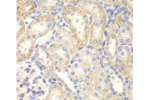 Immunohistochemistry of paraffin-embedded Rat kidney using DLC1 Polyclonal Antibody at dilution of 1:200 (40x lens). (DLC1 antibody)