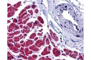 Immunohistochemistry (IHC) image for anti-Caspase 12 (Gene/pseudogene) (CASP12) (N-Term) antibody (ABIN1031295) (Caspase 12 antibody  (N-Term))