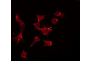 ABIN6272668 staining Hela by IF/ICC. (BCMA antibody  (Internal Region))