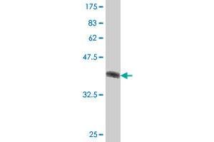 Western Blot detection against Immunogen (37. (DZIP3 antibody  (AA 1021-1120))