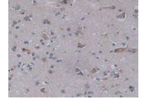 IHC-P analysis of Human Brain Tissue, with DAB staining. (JAG2 antibody  (AA 714-981))