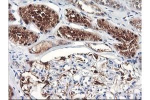 Immunohistochemical staining of paraffin-embedded Human Kidney tissue using anti-FBXO21 mouse monoclonal antibody. (FBXO21 antibody)