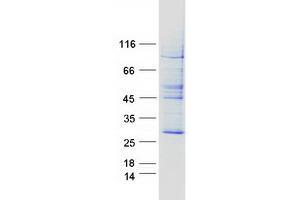 Validation with Western Blot (Der1-Like Domain Family, Member 2 (DERL2) protein (Myc-DYKDDDDK Tag))