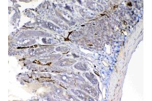 Immunohistochemistry (IHC) image for anti-Complement Factor D (CFD) (AA 26-263) antibody (ABIN5692793)