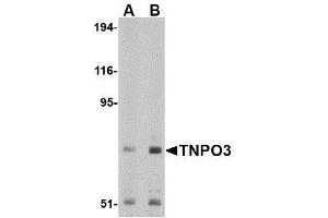 Image no. 1 for anti-Transportin 3 (TNPO3) (N-Term) antibody (ABIN1494359) (Transportin 3 antibody  (N-Term))