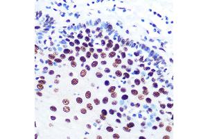 Immunohistochemistry of paraffin-embedded human esophageal using DDX5 Rabbit mAb (ABIN7266698) at dilution of 1:100 (40x lens).