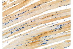 ABIN6261753 and ABIN6276862 at 1/100 staining Rat muscle tissue by IHC-P.
