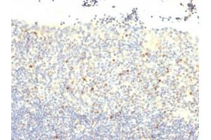 Image no. 1 for anti-Forkhead Box P3 (FOXP3) antibody (ABIN6163142) (FOXP3 antibody)