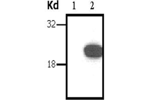 Image no. 1 for anti-DIRAS Family, GTP-Binding RAS-Like 3 (DIRAS3) antibody (ABIN790752)