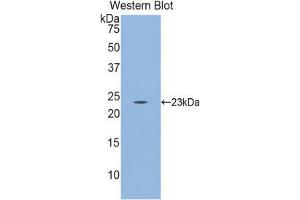 Western Blotting (WB) image for anti-CD8b Molecule (CD8B) (AA 21-208) antibody (ABIN1858317)