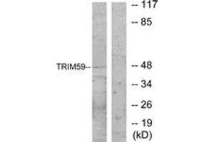 Western blot analysis of extracts from NIH-3T3 cells, using TRIM59 Antibody.