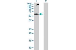 Western Blot analysis of NUP62 expression in transfected 293T cell line by NUP62 MaxPab polyclonal antibody. (NUP62 antibody  (AA 1-522))
