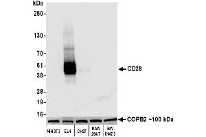 Western Blotting (WB) image for anti-CD28 (CD28) (AA 170-220) antibody (ABIN7455122) (Recombinant CD28 antibody  (AA 170-220))