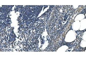 IHC analysis of LSM7 using anti-LSM7 antibody (ABIN7598937). (LSM7 antibody  (AA 1-103))