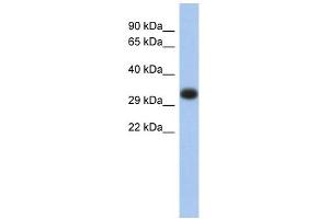 HLA-DPA1 antibody used at 1 ug/ml to detect target protein. (HLA-DPA1 antibody  (Middle Region))