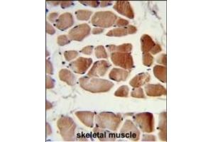 Immunohistochemistry (Paraffin-embedded Sections) (IHC (p)) image for anti-RuvB-Like 1 (E. Coli) (RUVBL1) antibody (ABIN650671)