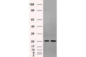 Image no. 2 for anti-Replication Protein A2, 32kDa (RPA2) antibody (ABIN1500733)
