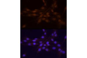 Immunofluorescence analysis of PC-12 cells using Chk1 Rabbit pAb (ABIN6134818, ABIN6138518, ABIN6138519 and ABIN6223572) at dilution of 1:25 (40x lens).