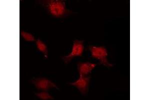 ABIN6267458 staining K562 by IF/ICC. (ENOS antibody  (pSer1177))