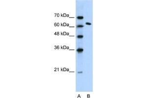 Western Blotting (WB) image for anti-FACT complex subunit SPT16 (SUPT16H) antibody (ABIN2460242) (SUPT16H antibody)