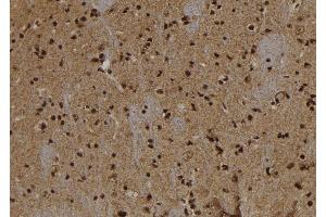 ABIN6273031 at 1/100 staining Rat brain tissue by IHC-P.