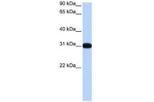 MBNL2 antibody used at 0. (MBNL2 antibody  (Middle Region))
